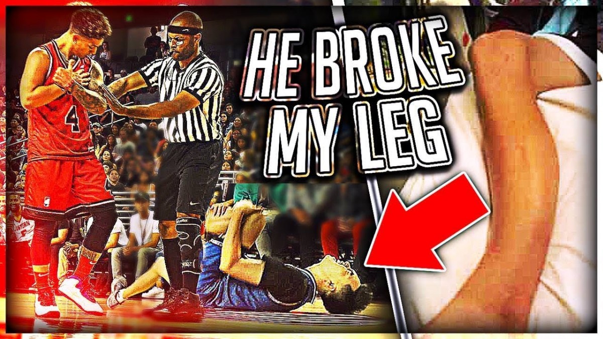 Artistry in Games He-Broke-My-Leg-At-Ace-Family-Event-Charity-Basketball-Highlights He Broke My Leg At Ace Family Event (Charity Basketball Highlights) News